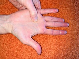 Self-Care Hand Reflexology