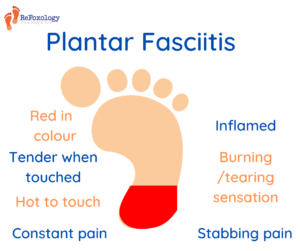 Signs and symptoms of plantar fasciitis
